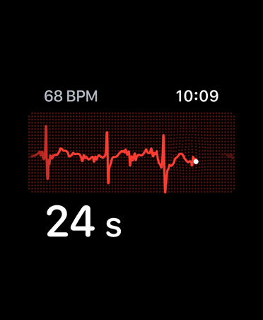 App ECG, battements par minute dans le coin supérieur droit, ligne de fréquence, minuterie